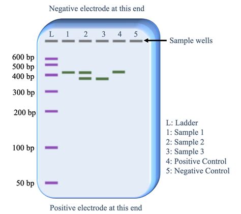 how to read pcr gel|How to Read a Gel Image .